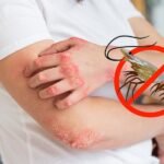 Cara Mengatasi Alergi Udang - Info Malang Raya