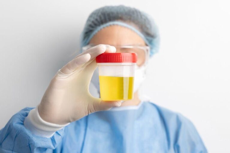 Fakta Piuria: Urine Berwarna Nanah