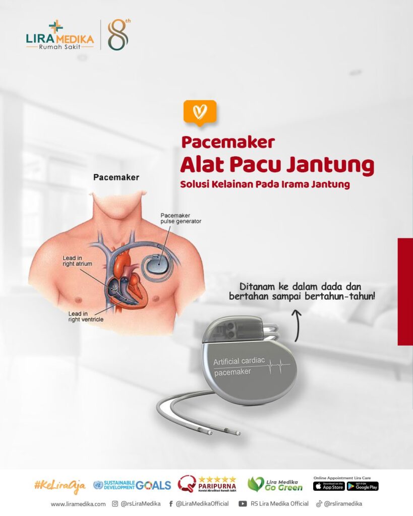 Mikayli Bersemangat Meski Hidupnya Kini Bergantung pada Alat Pacu Jantung