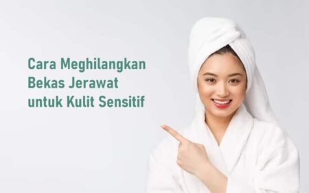 Cara Cepat Menghilangkan Bekas Jerawat untuk Kulit Mulus