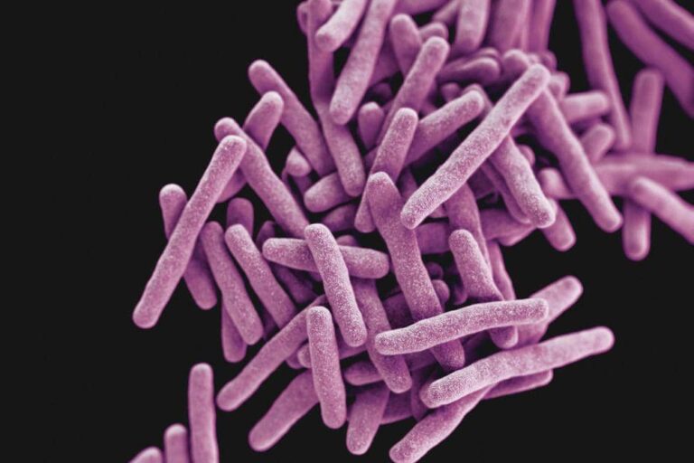 Apa Penyebab TBC? Hindari Kebiasaan Ini!