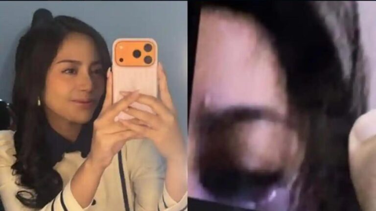 Mata kiri Rachel Vennya jadi sorotan, luka ramai dibahas di medsos