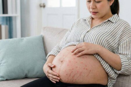 Waspada! 9 Penyakit Kulit Umum Saat Hamil
