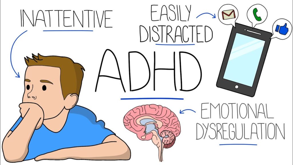 ADHD atau Perimenopause? Kenali Ciri-cirinya untuk Diagnosis yang Tepat