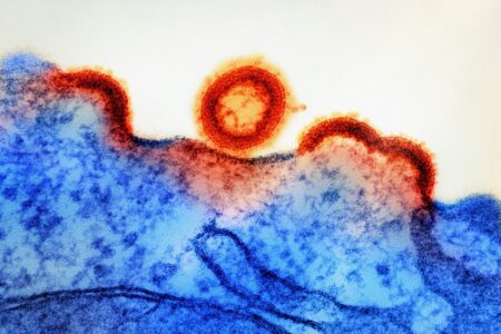 Cara Membaca Hasil Tes HIV yang Tepat dan Akurat