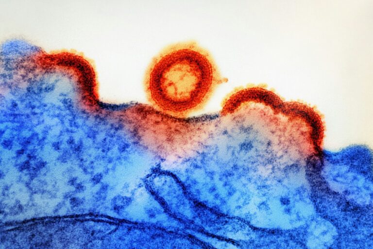 Cara Membaca Hasil Tes HIV yang Tepat dan Akurat